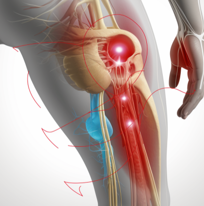 https://backmusclesolutions.com/cdn/shop/articles/How_to_cure_sciatica_permanently_grande.png?v=1703057279